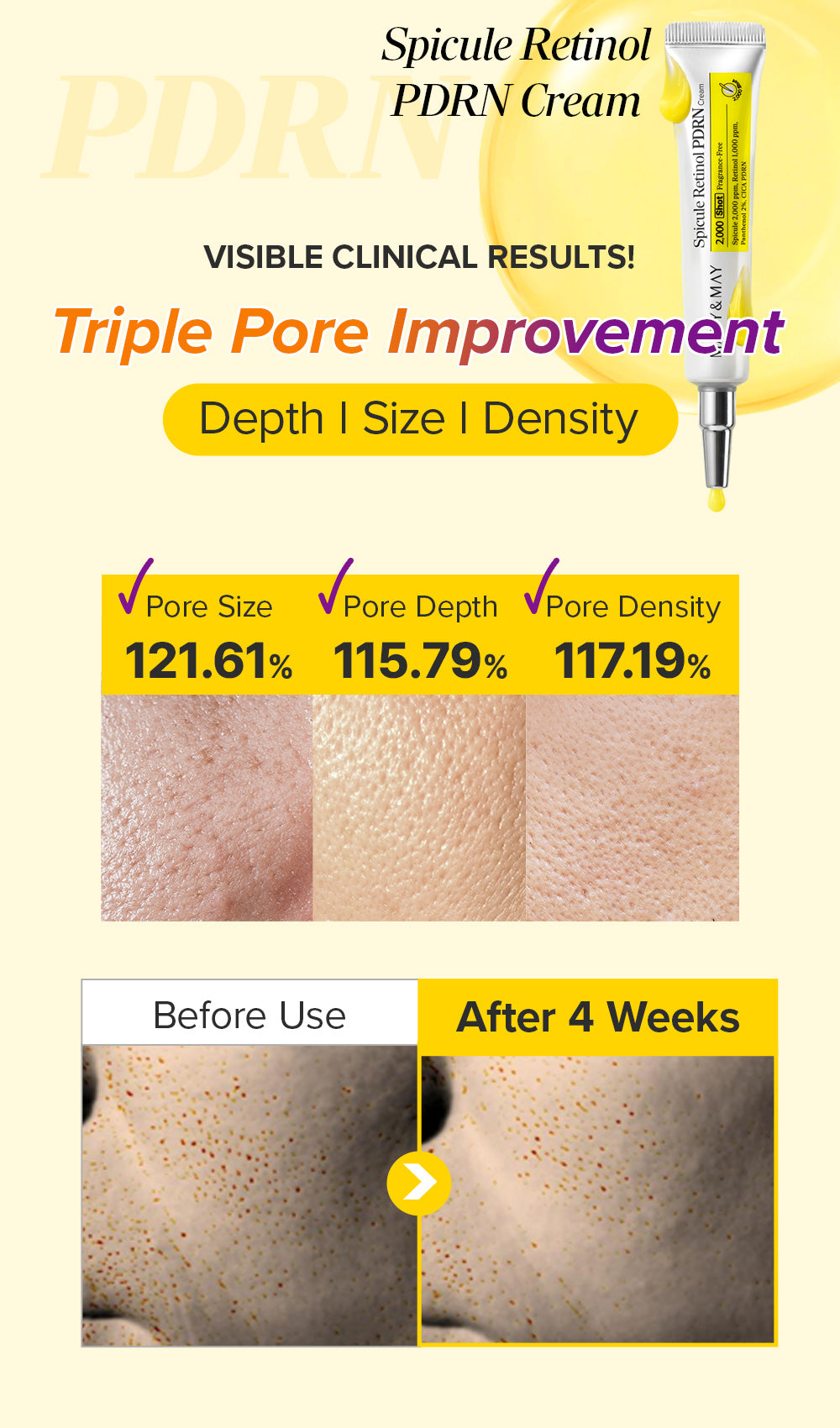 [Amazon Hot Selling🔥] Spicule Retinol PDRN Cream