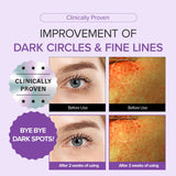 [Amazon Hot Selling🔥] Dark Circle + Brightening Eye Cream