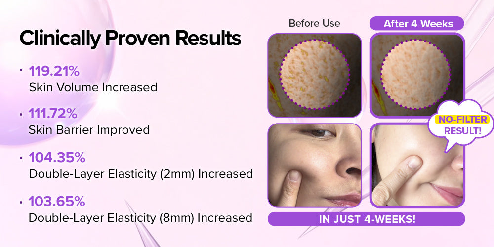 [Amazon Hot Selling🔥] Spicule Collagen PDRN Cream