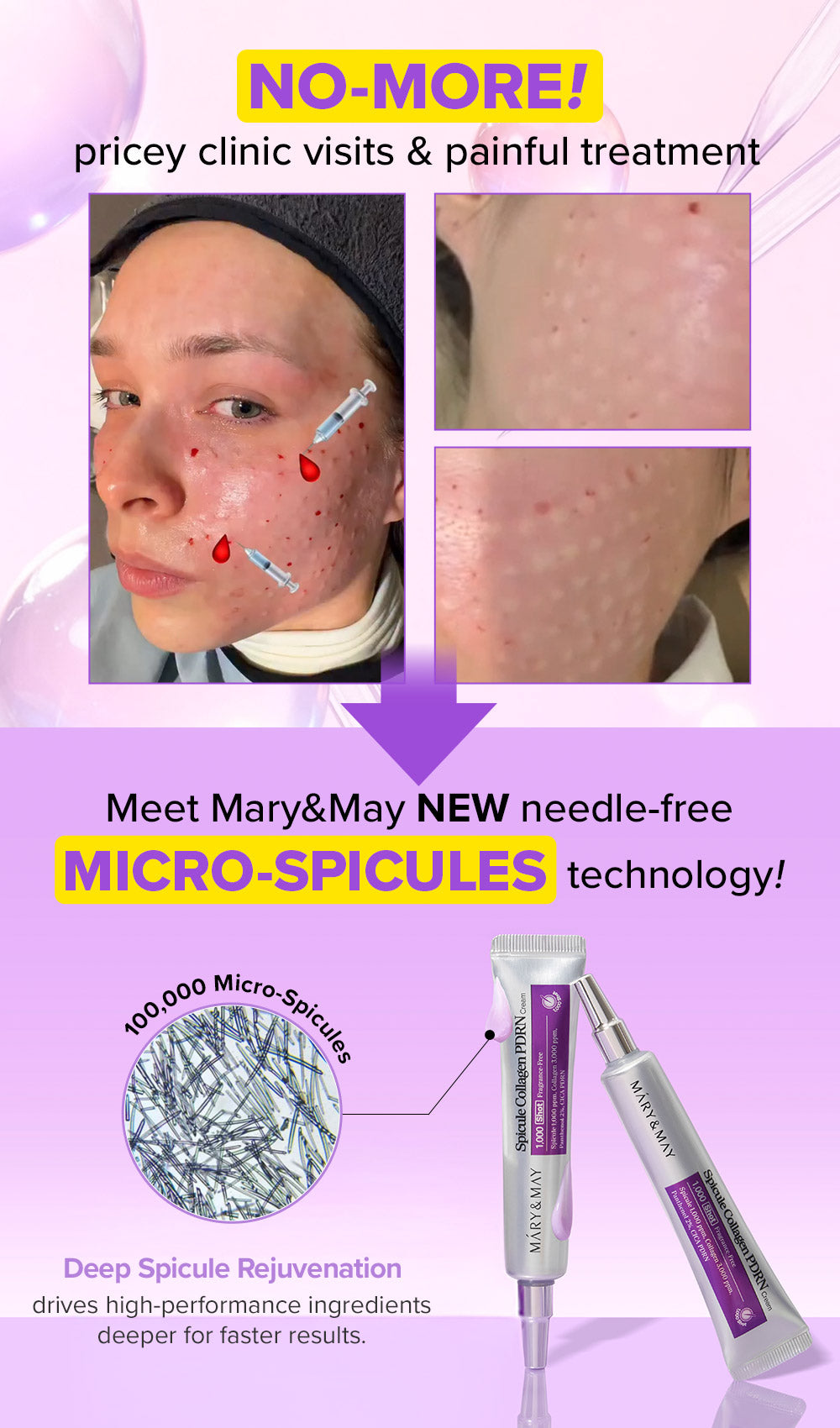 [Amazon Hot Selling🔥] Spicule Collagen PDRN Cream