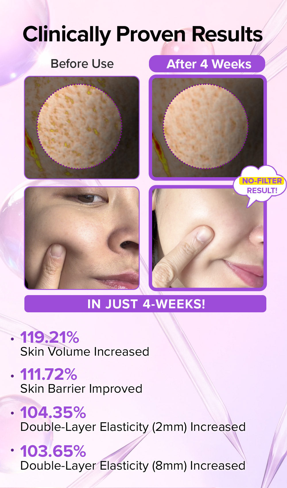 [Amazon Hot Selling🔥] Spicule Collagen PDRN Cream