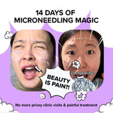 [Amazon Hot Selling🔥] Spicule Collagen PDRN Cream