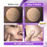 [Amazon Hot Selling🔥] Spicule Collagen PDRN Cream