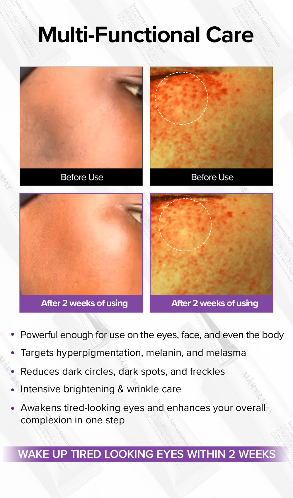 glutathione eyes before after Essential Fx Acyl-Glutathione Eyelid Lift Serum